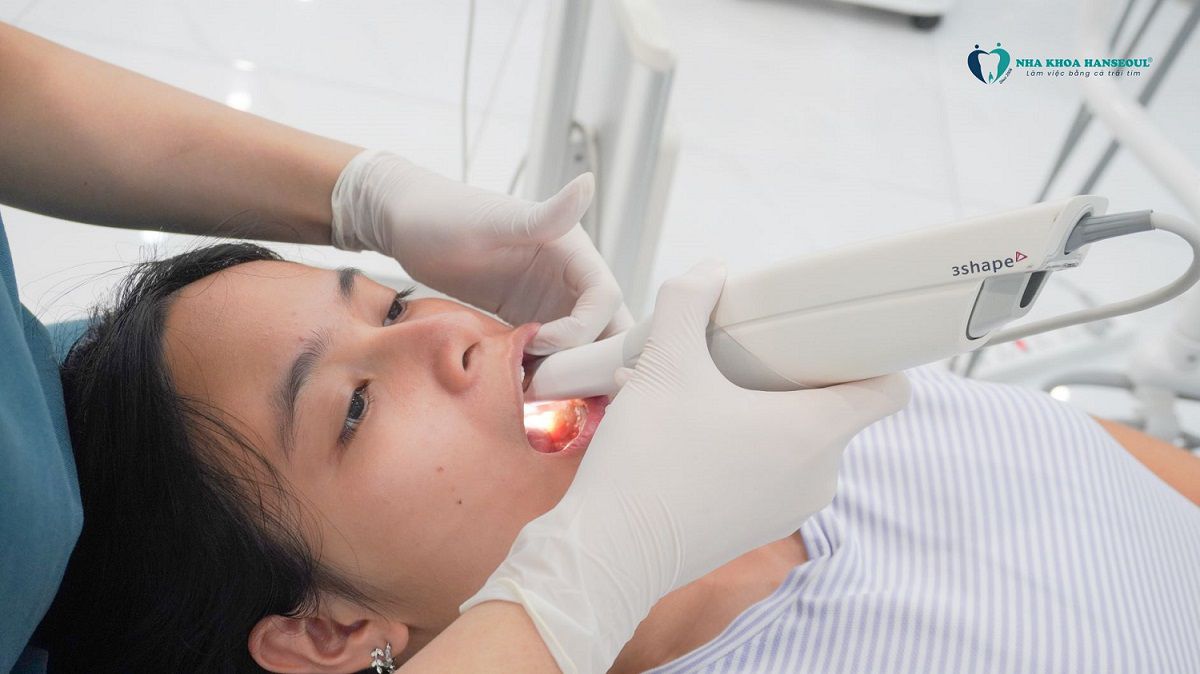 Máy lấy dấu răng 3Shape.